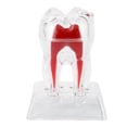 thumbnail image 2 of Modelo de dientes dentales, herramienta educativa para estudiantes de endodoncia, dientes de plástico separables, 2 of 5