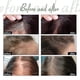 thumbnail image 4 of OUHOE dense hair essence essence moisturizing hair strong and firm hair anti-hair loss dense h, 4 of 4