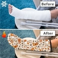 thumbnail image 7 of COEQINE Cute Corgi Leg Cast Covers Size S Cast Sleeve for Foot Leg Protector Reusable Cast Covers for Shower Leg Decorative Leg Cast Cover Knee Cast Sock for Adult Kids, 7 of 7