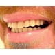 thumbnail image 4 of Instant Smile Comfort Fit Flex Teeth Upper Lower Matching Set Natural Shade Fix Your Smile At Home Within Minutes Cosmetic Enhancement Product CD.., 4 of 5