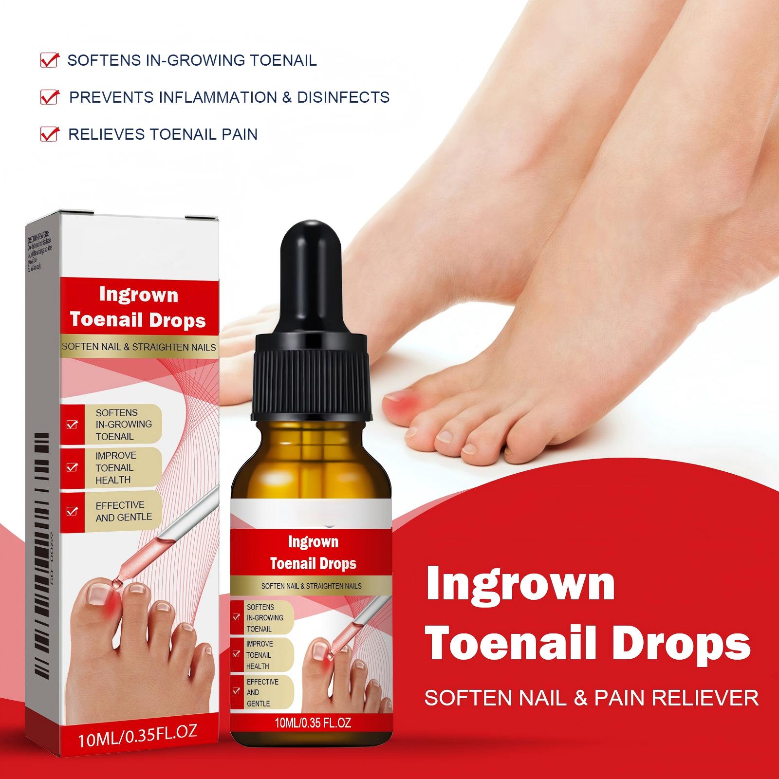Alvantor Ingrown Toenail Essence Moisturizing Nail Care Oil for Damaged Toenails, 10ml