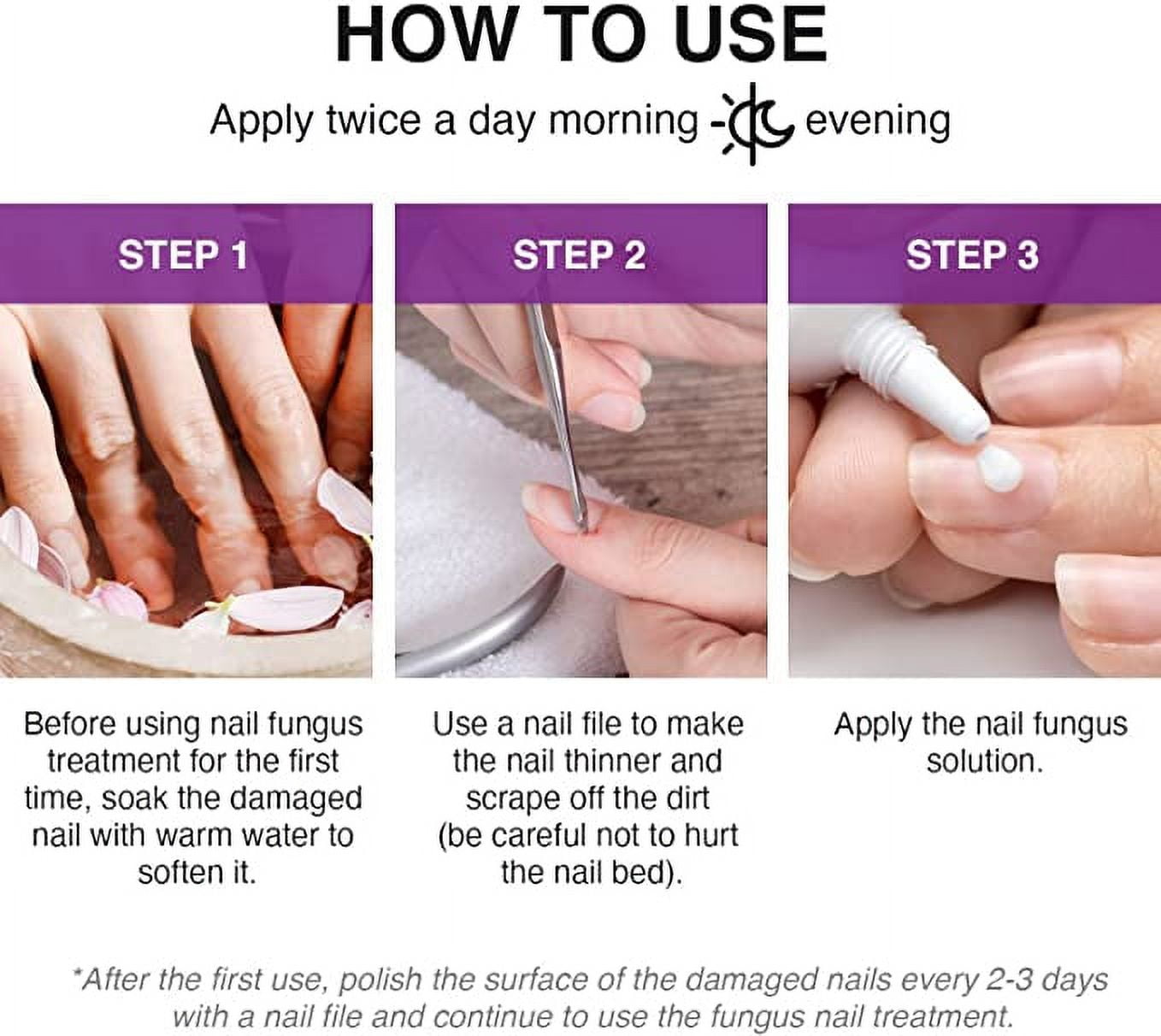 Top 5 home remedies for toenail fungus | TheHealthSite.com