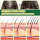 thumbnail image 3 of Spray para el crecimiento del cabello con ginseng y sérum de jengibre para el crecimiento del cabello fino y la nutrición del cuero cabelludo (6 unidades), 3 of 5