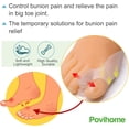 thumbnail image 3 of 8 Pack Bunion Cushion and Protector (1/2''Thick), Bunion Pads, Bunion Corrector and Bunion Relief with Gel Shield, Treat Pain in Big Toe Joint, Realign Big Toe and Relieve Bunion Pain, 3 of 5