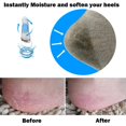 thumbnail image 5 of Codream Vented Moisturizing Socks Lotion Gel For Dry Cracked Heels Spa Gel Socks Humectant Moisturizer Heel Balm Foot Treatment Care Heel Softener Compression (2 Pairs), 5 of 5