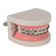 thumbnail image 5 of Modelo Avanzado de Ortodoncia con Soportes Metálicos Duraderos, 5 of 5