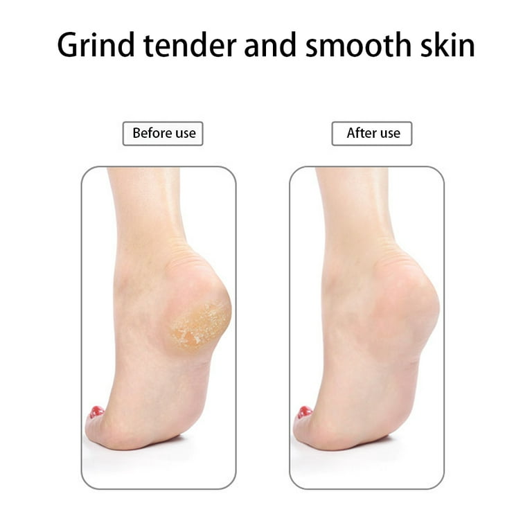 Double Side Foot Skin Grinding Stone Dead Skin Remover Foot Callous Removal  Tool Foot Care Tool