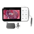 thumbnail image 1 of Digital Otoscope Visual Comfortable Ear Camera Earpick Ear Wax Removal Tool with 4.5in Display, 1 of 5