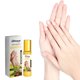 thumbnail image 1 of Aceite Hidratante Reparador Antipadrastros En Roll-On | Cuidado de Uñas, Manos, Pies y Uñas - 10 Ml, 1 of 5