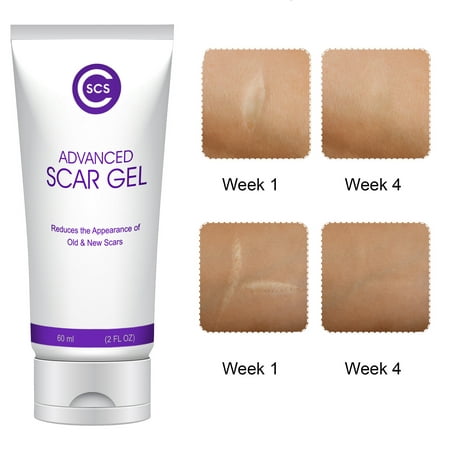 CSCS Most Effective Scar Remover Cream with Hydrolyzed Collagen & Vitamin E - Heals Old & New Scars from Cuts, Acne, Stretch Marks, Burns & Post Surgeries Scars - Fast Results, for All Skin Types 2 (Best Scar Cream For Old Scars)