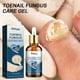 thumbnail image 1 of Gel crema para uñas onicomicosis Gel para eliminar hongos en las uñas productos para reparación de uñas de los pies, 1 of 9