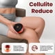 thumbnail image 4 of Smart Cupping Therapy with Red Light, Electric Cellulite Massager for Blood Circulation, Cellulite Reduction & Muscle Relief, 4 of 5