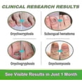 thumbnail image 3 of 30ml Toenail Fungus Treatment, Tea Tree Oil For Toenail Fungus, Antifungal Nail Solution Care Essence, 3 of 5