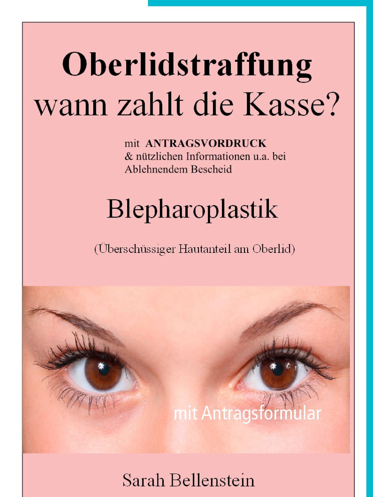 Oberlidstraffung - Wann zahlt die Kasse? - eBook - Walmart ...