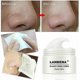 thumbnail image 1 of Lanbena Removedor De Espinillas Mascarilla Nasal Poro Negro Peel Off Acné + 60x Tiras De Papel, 1 of 5