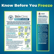 Skin Clinic FREEZE n CLEAR™ Advanced Wart Remover, Tough on Warts, Gentle on Skin, (12 Applicators)
