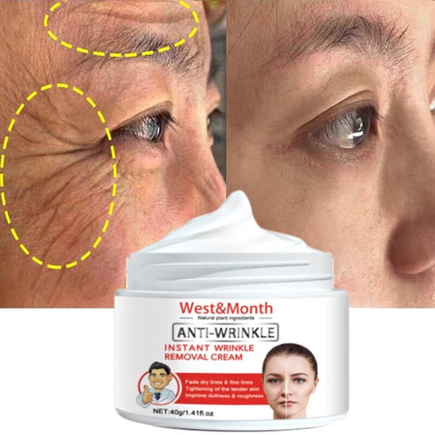 JoyPretty crema Herbal para eliminar cicatrices, tratamiento de manchas de acné, aclara las cicatrices antiguas, blanqueamiento suave, cuidado de la piel, 40g"one" Fivean LED