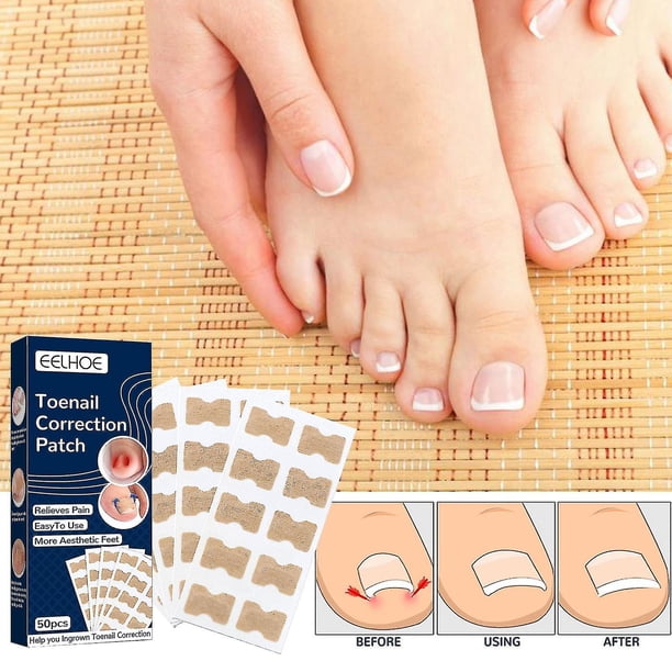 50 Uds. Adhesivo para uñas encarnadas con herramienta para cepillar las uñas de los pies, parche corrector para uñas de los pies, pegatina correctora para los dedos del pie, sin pegamento
