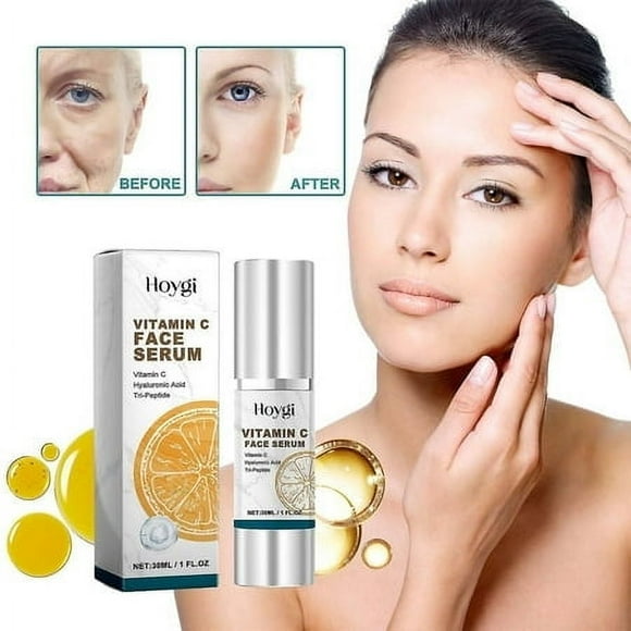 Total Package Serum, Vitamin C, Hyaluronic Acid, Vitamin C Face Serum, Reduces Dark Spots Skin Brightening Vitamin C Face Serum