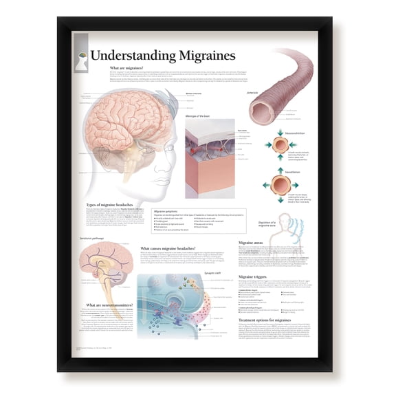 Understanding Migraines Framed Medical Educational Informational Poster Diagram Doctors Office School Classroom 22x28 Inches