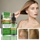thumbnail image 3 of Crecimiento del cabello Peluquería Esencia Aceite Nutrición Suero Tratamiento para la pérdida de cabello Likrtyny Cuidado Belleza, 3 of 6