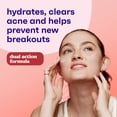thumbnail image 2 of Clean & Clear Essentials Dual Action Acne Facial Moisturizer, 4 fl. oz, 2 of 11
