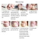 thumbnail image 5 of Ingrown Toenail Pedicure Tool 10Pcs/Bottle Straightening Clip Curved Bs Brace Toenails Thick Paronychia Correction Tool Foot, 5 of 5