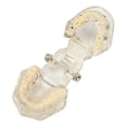 thumbnail image 3 of Modelo Patológico De Implante Dental, Modelo Patológico De Implante Dental Transparente Modelo De Dientes De Enfermedad De Implante Para Demostración De Enseñanza, 3 of 5
