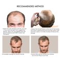 thumbnail image 4 of Hair Loss Treatment Hair Growth Natural Fast Hair Growth Essence Ginseng Hair Loss Treatment Liquid Sprayer 30ml ANGGREK Otros, 4 of 8