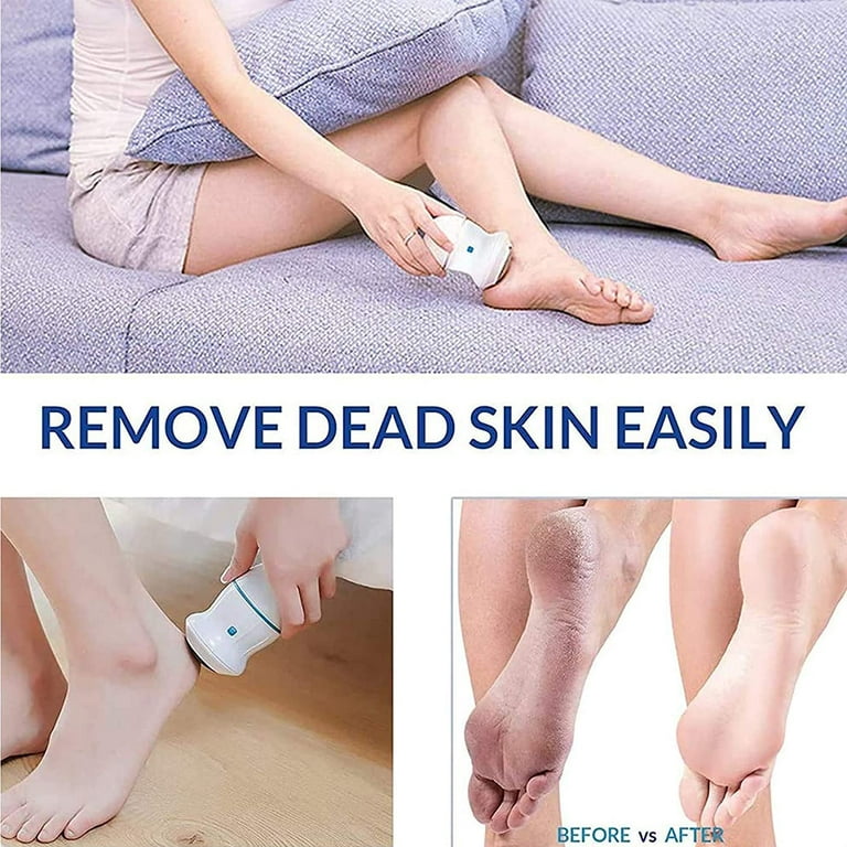 Electric Callus Remover, Rechargeable Electronic Feet File Hard Skin R -  Fulfillment Center
