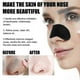 thumbnail image 4 of Blackhead Nose Patch, Blackhead Pore Strips, Deep Charcoal Pore Cleansing Strips, Nose Blackhead Remover Strips for All Ski, 4 of 5