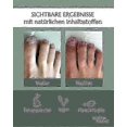 thumbnail image 4 of 5x Healthroutine Nail Care Pen Cosmetic Nail Fungus Treatment Quick Intensive For Nails With Aloe Vera Tea Tree Oil_c5_y146, 4 of 5