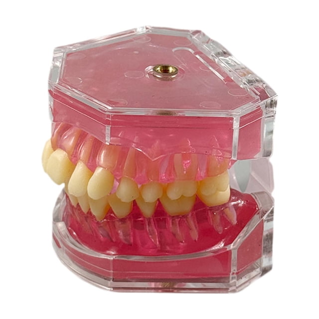 Modelo de enseñanza oral,Modelo de extracción dental Modelo de enseñanza oral,Kit educativo para la práctica de extracción de dientes,Instrumento dental modelo didáctico
