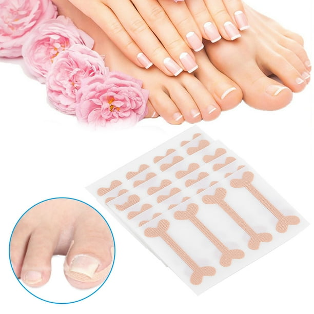Tebru 24pcs Ingrown Toenail Correction Bandage Pain Relief Paronychia Treatment Band Sticker