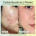 thumbnail image 4 of Serum KraveBeauty Great Barrier Relief, paquete de 2 unidades, 45 ml, 4 of 9