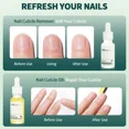 thumbnail image 5 of Nailpop-eliminador de cutículas y aceite para cutículas, Kit de cuidado de uñas, tratamiento de uñas para uñas dañadas, producto para eliminar la piel muerta, manicura, 5 of 5