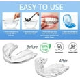 thumbnail image 5 of Kidsjoy Moldable Mouth Guards for Nighttime Teeth Grinding, 2 Sizes Dental Guards for Clenching Teeth at Night for Adults and Kids, 8 Pcs, 5 of 7