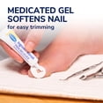 thumbnail image 2 of Dr. Scholl's INGROWN TOENAIL PAIN RELIEVER & TRIMMING KIT, 0.3 oz // Only OTC Treatment Proven to Relieve Ingrown Toenail Pain - Includes Medicated Gel + Foam Rings Bandages Clipper Pusher Tools, 2 of 5
