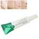 thumbnail image 4 of Gel De Aloe Vera Para Acné, Gel Antiinflamatorio Que Limpia Los Poros Para La Escuela, El Hogar, La Oficina, 4 of 7