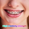 thumbnail image 4 of 80 Pieces Multi-Color Orthodontic Ligature Ties Orthodontic Elastic 2080 O-Rings Braces Bands, 4 of 7