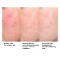 thumbnail image 4 of Recombinant Collagen Protein Serum, Lifting Soothe Collagen Protein Solution  For Micropigmentation, 4 of 8
