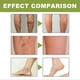 thumbnail image 4 of 50g Anti-Varicose Soothing Cream Relieve Soothing Swelling Pain Leg Cream for Women Men, 4 of 5