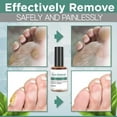 Siquannnn Corn Removal Extra Strengthen Gel Foot Callus Removal