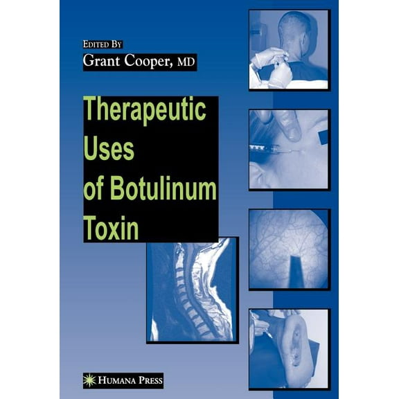 Musculoskeletal Medicine Therapeutic Uses of Botulinum Toxin, (Paperback)