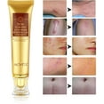 thumbnail image 6 of Aliver Scar Cream - TCM Scar and Acne Mark Removal Gel Ointment for Scars, Burns, Stretch Marks, Acne Spots, Skin Redness Curing, 6 of 7