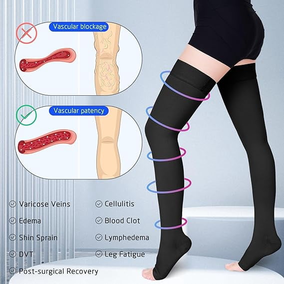 MecTo 15-20mmHg Open Toe Compression Stockings Medical Thigh High Compression Socks for Running Nursing Sports Veins( Black, L)