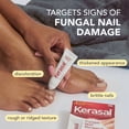 thumbnail image 4 of Kerasal Nail Fungus Extra Strength | Restorative Nail Repair for Damaged Nails, 0.33 fl oz, 4 of 14