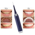thumbnail image 3 of Removedor de cálculo dental eléctrico Limpiador de dientes Removedor de sarro Carga USB Labymos  Natural, 3 of 7