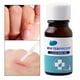 thumbnail image 5 of Liquid 10ml Cuts Pegamento Sellos para Lesiones Heridas Cortes, 5 of 9