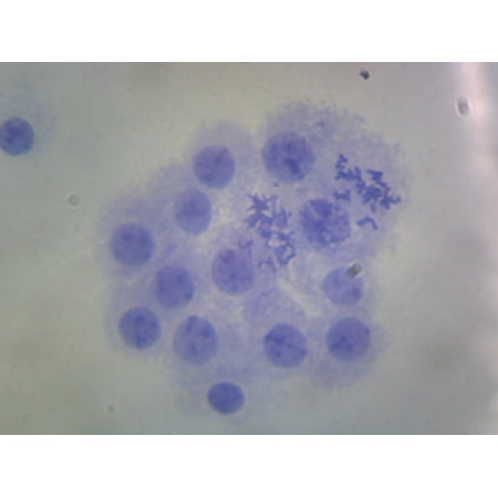 Male Chromosomes, Human; Smear by Go Science Crazy